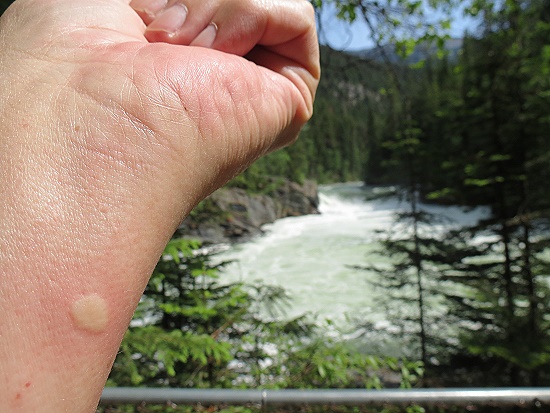 Overlander Falls mit Mckenstich